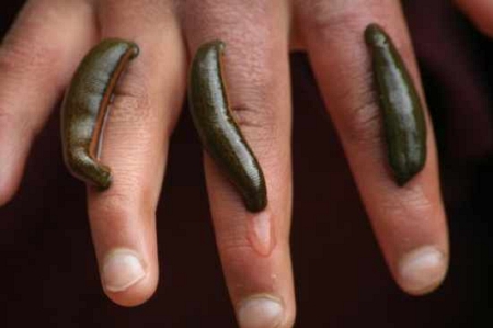 neobyichnyie-sposobyi-izlecheniya-bolnyih-primenyaemyie-vrachami-proshlogo_3